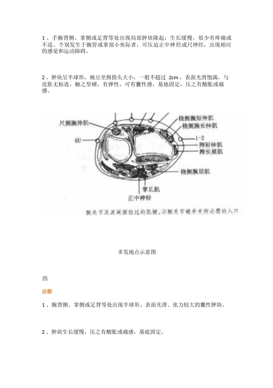 四肢腱鞘囊肿的治疗详解_第2页