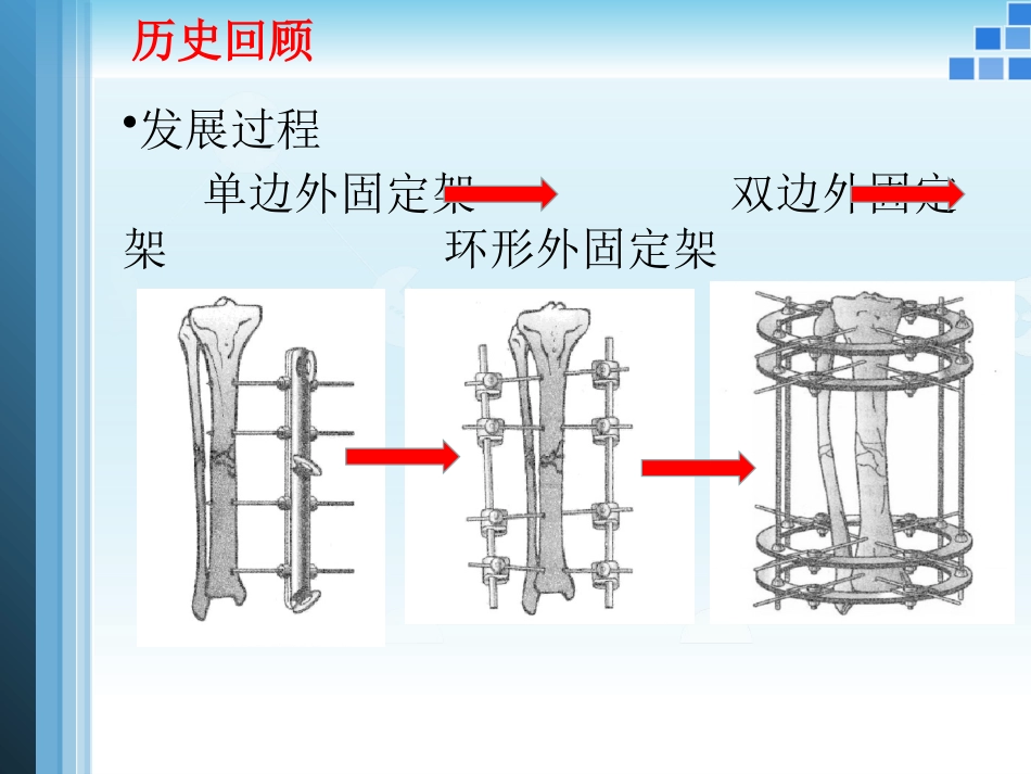 外固定支架的力学原理_第3页