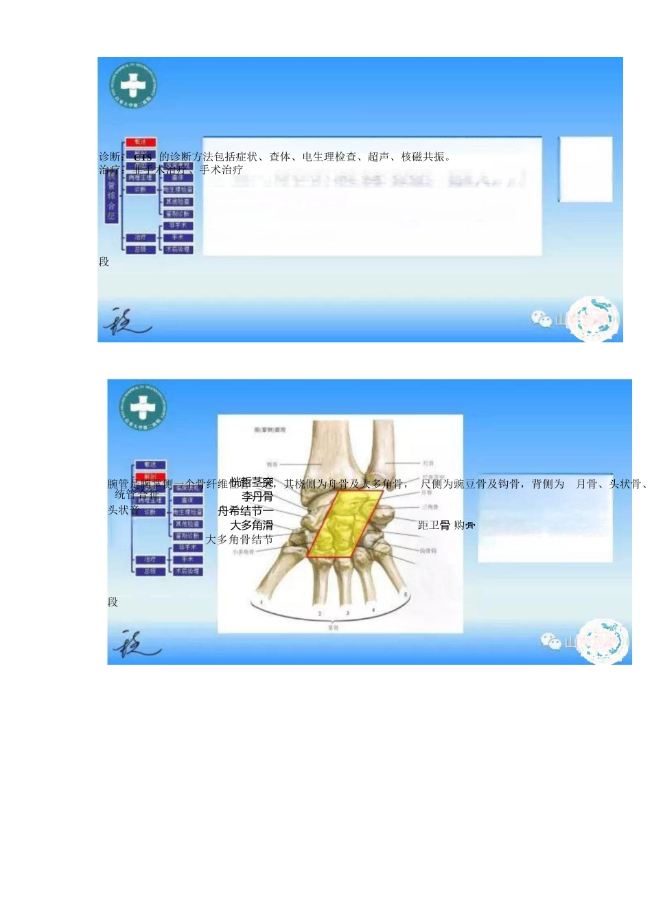 腕管综合征的诊断与治疗策略_第2页