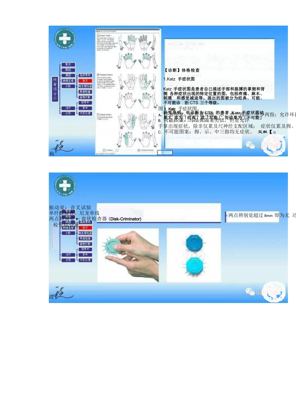 腕管综合征的诊断与治疗策略_第9页
