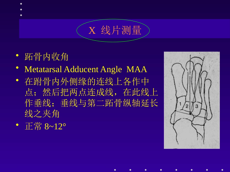拇外翻分型及治疗_第15页
