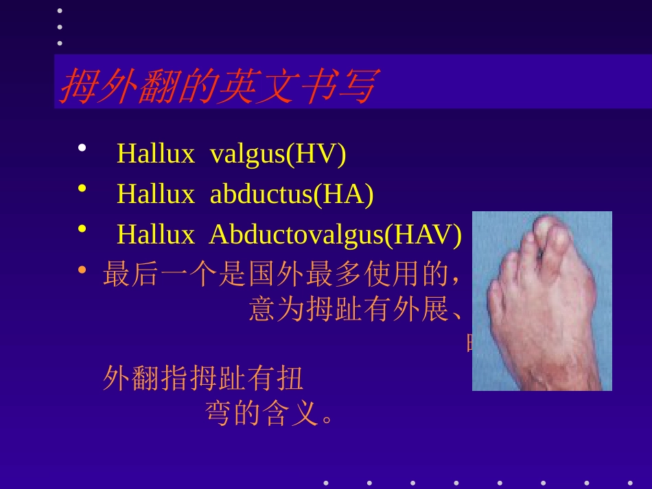 拇外翻分型及治疗_第2页