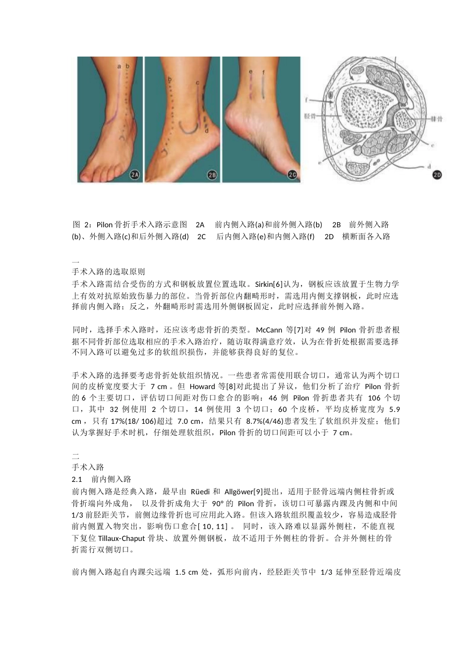 Pilon骨折的手术入路解析_第2页