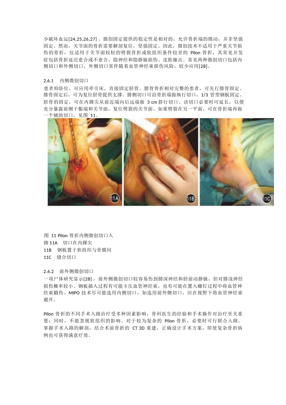 Pilon骨折的手术入路解析_第8页