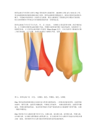 Pilon骨折的手术入路解析