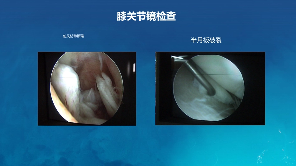 膝关节炎护理查房_第10页