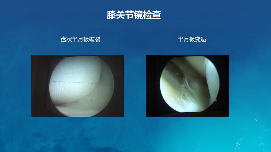 膝关节炎护理查房_第11页