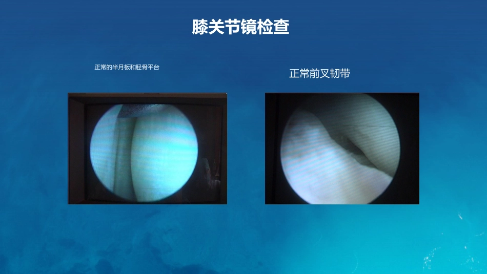 膝关节炎护理查房_第9页