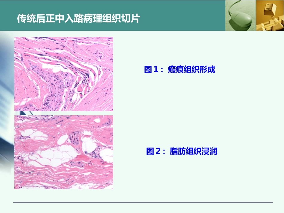 最全胸腰椎椎弓根置钉技术_第12页