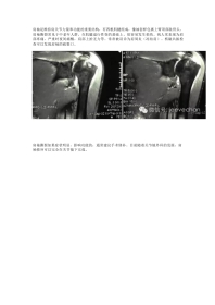 关节镜下肩袖修补的手术技巧