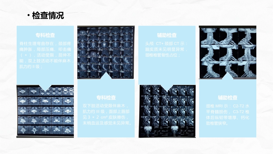 脊髓损伤的护理查房_第6页