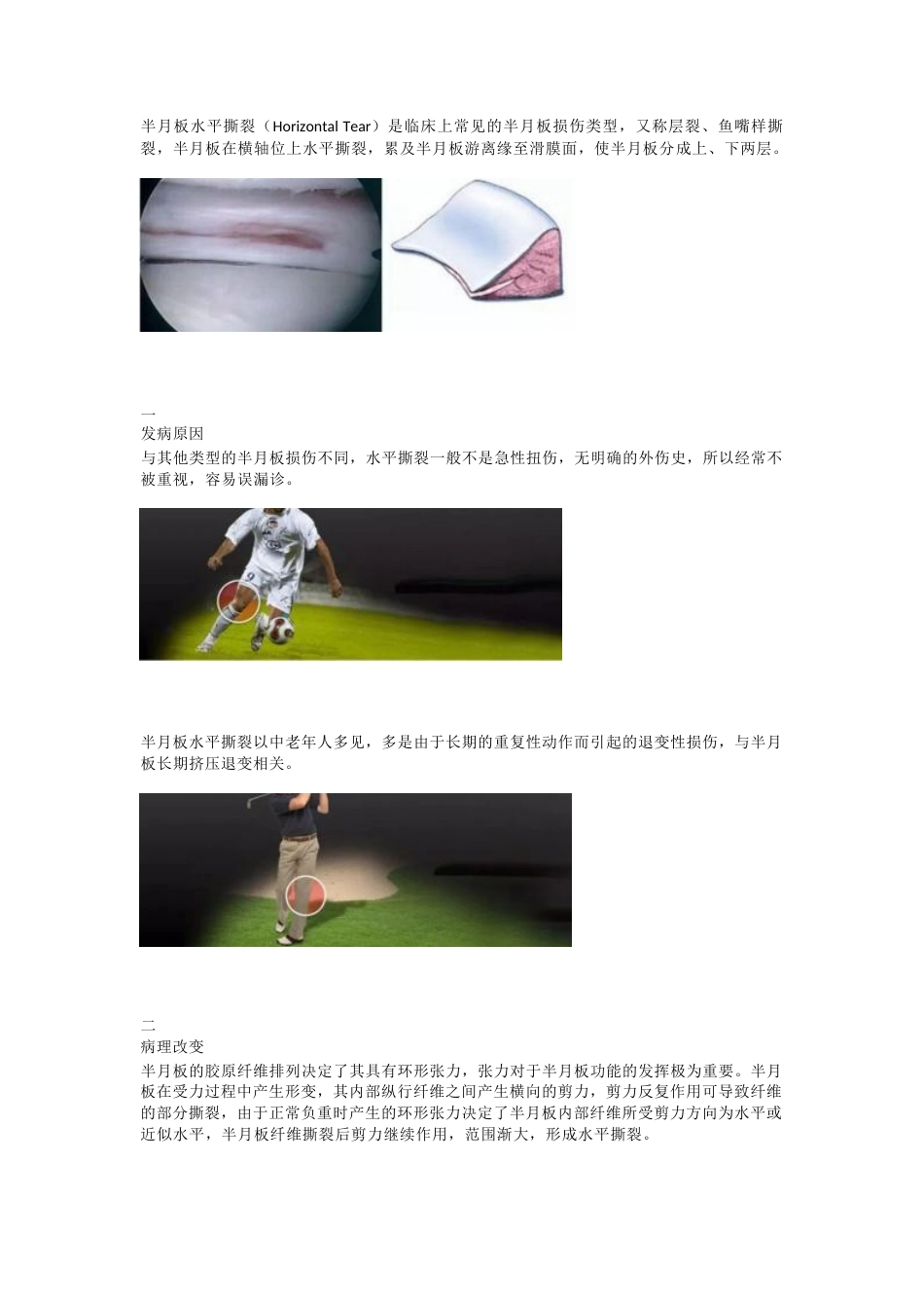 半月板水平撕裂的临床诊治技巧_第1页