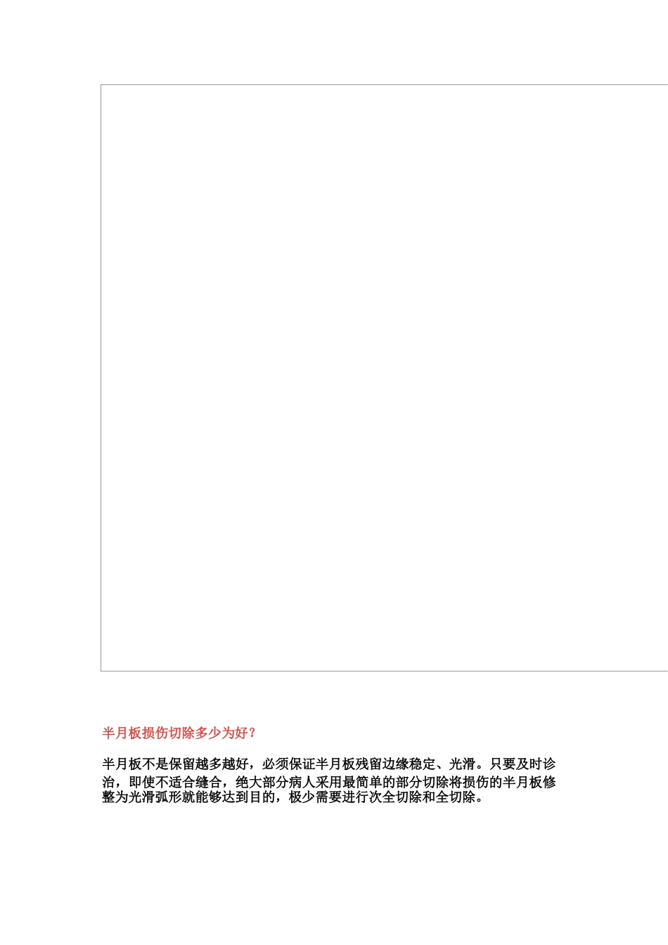 半月板损伤的治疗技巧_第13页