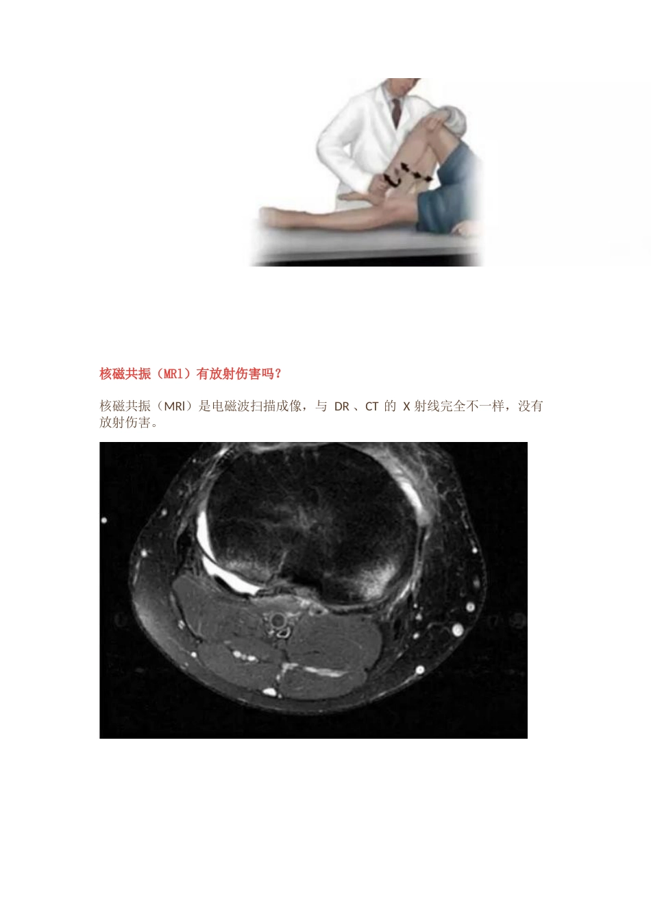 半月板损伤的治疗技巧_第5页