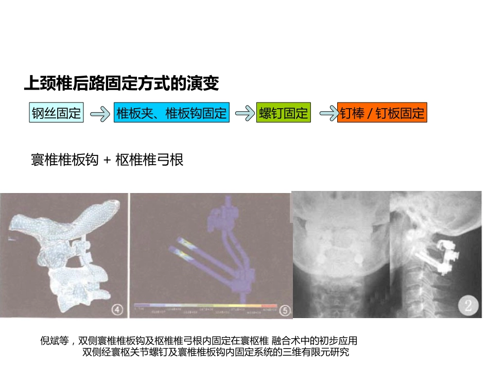 上颈椎后路内固定技术- 复件_第7页
