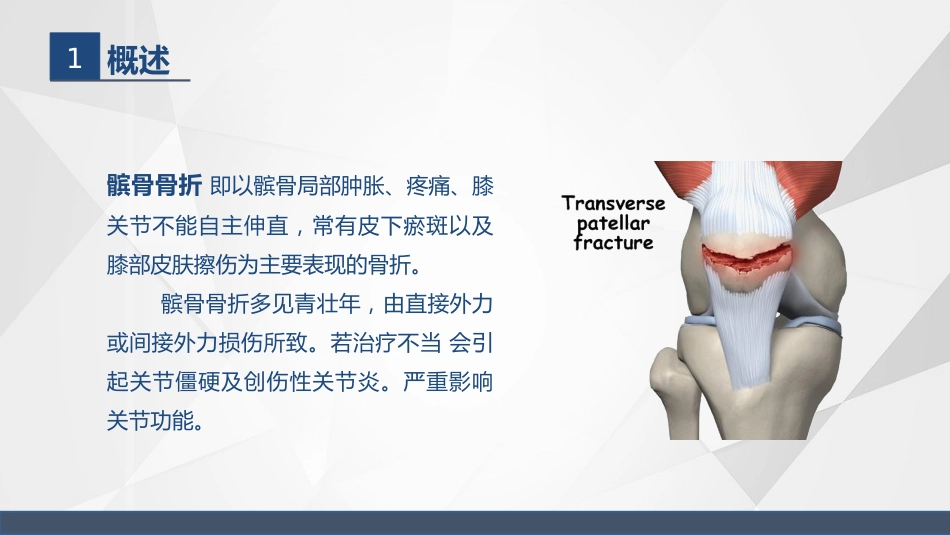 髌骨骨折的护理_第4页