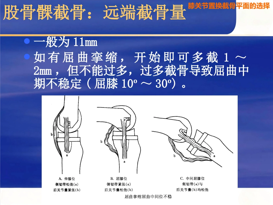 膝关节置换截骨面的决定_第11页