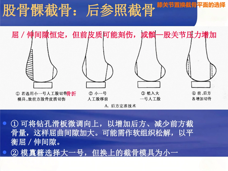 膝关节置换截骨面的决定_第15页