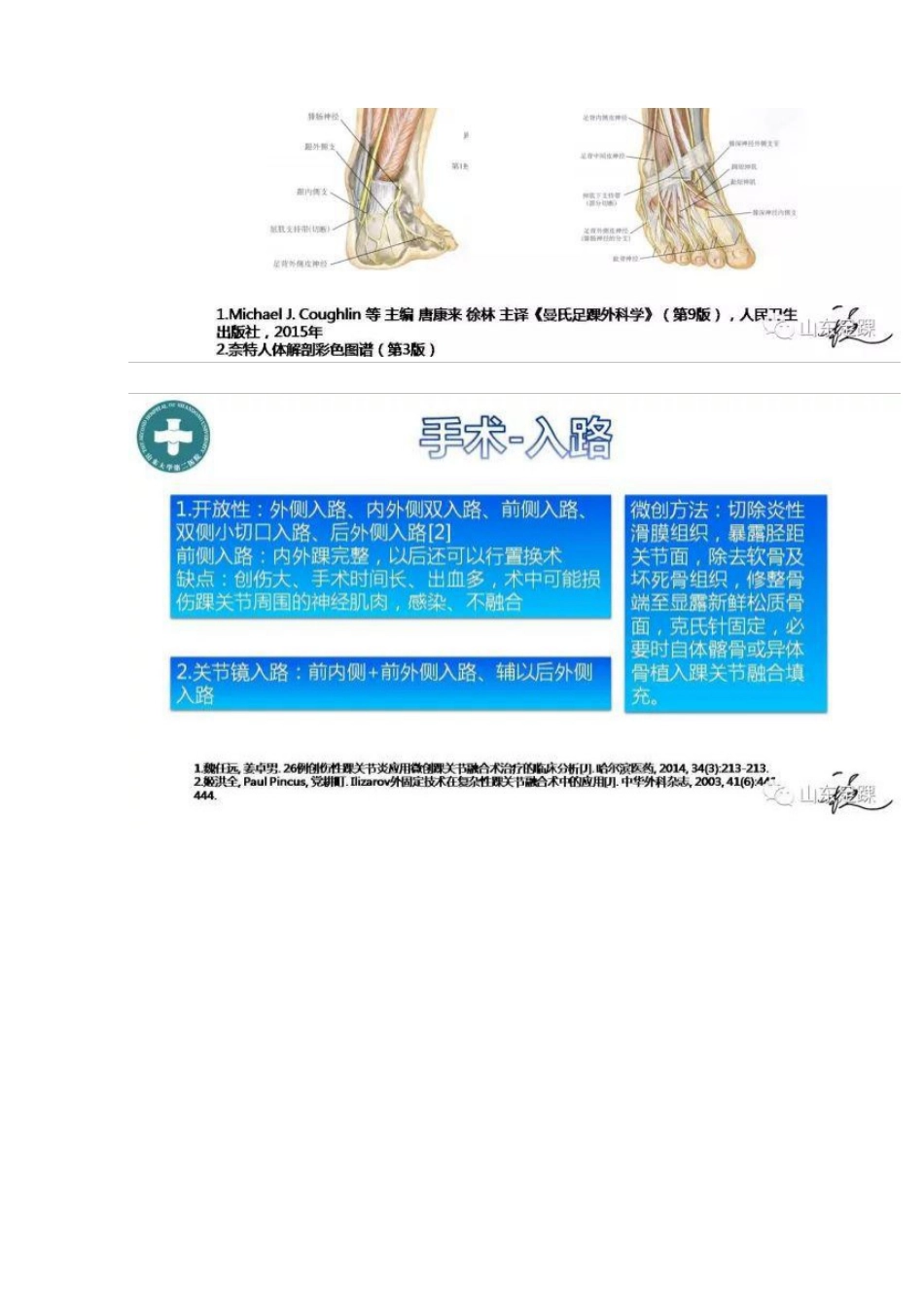 踝关节融合术的基本手术策略与技巧_第13页