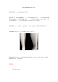 胫骨远端骨折髓内钉固定技巧