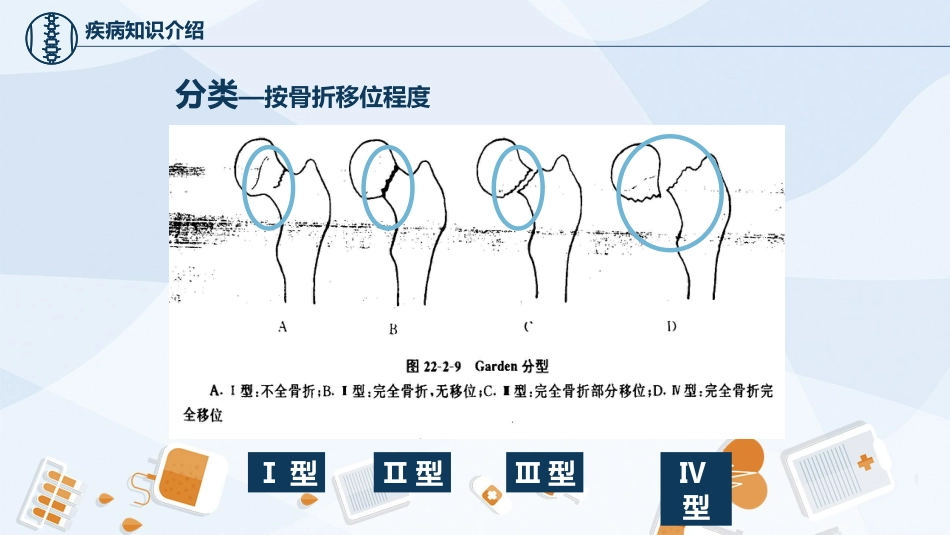 骨科-股骨颈骨护理查房_第15页