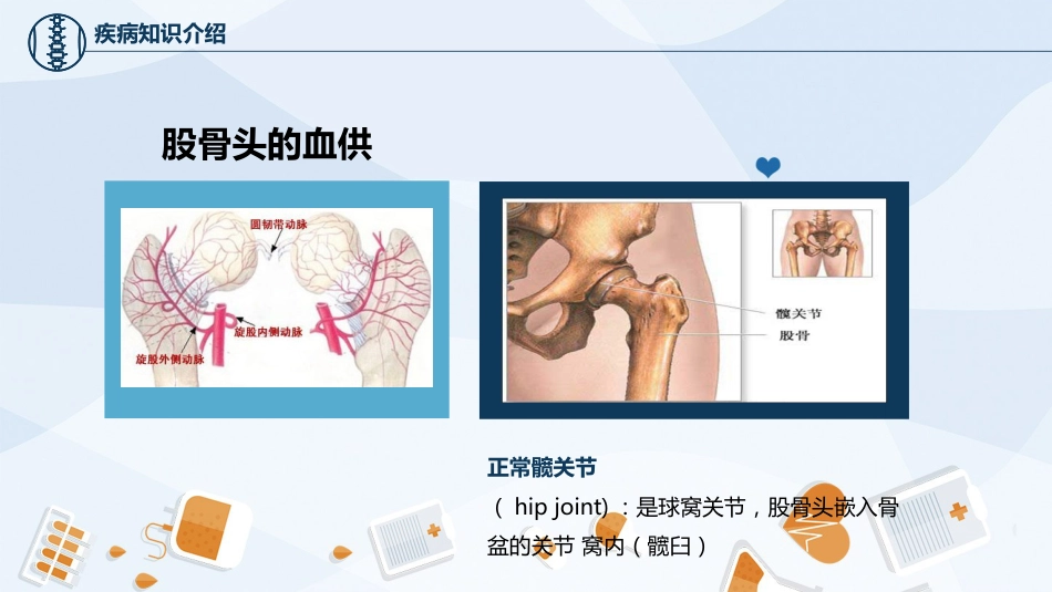 骨科-股骨颈骨护理查房_第9页