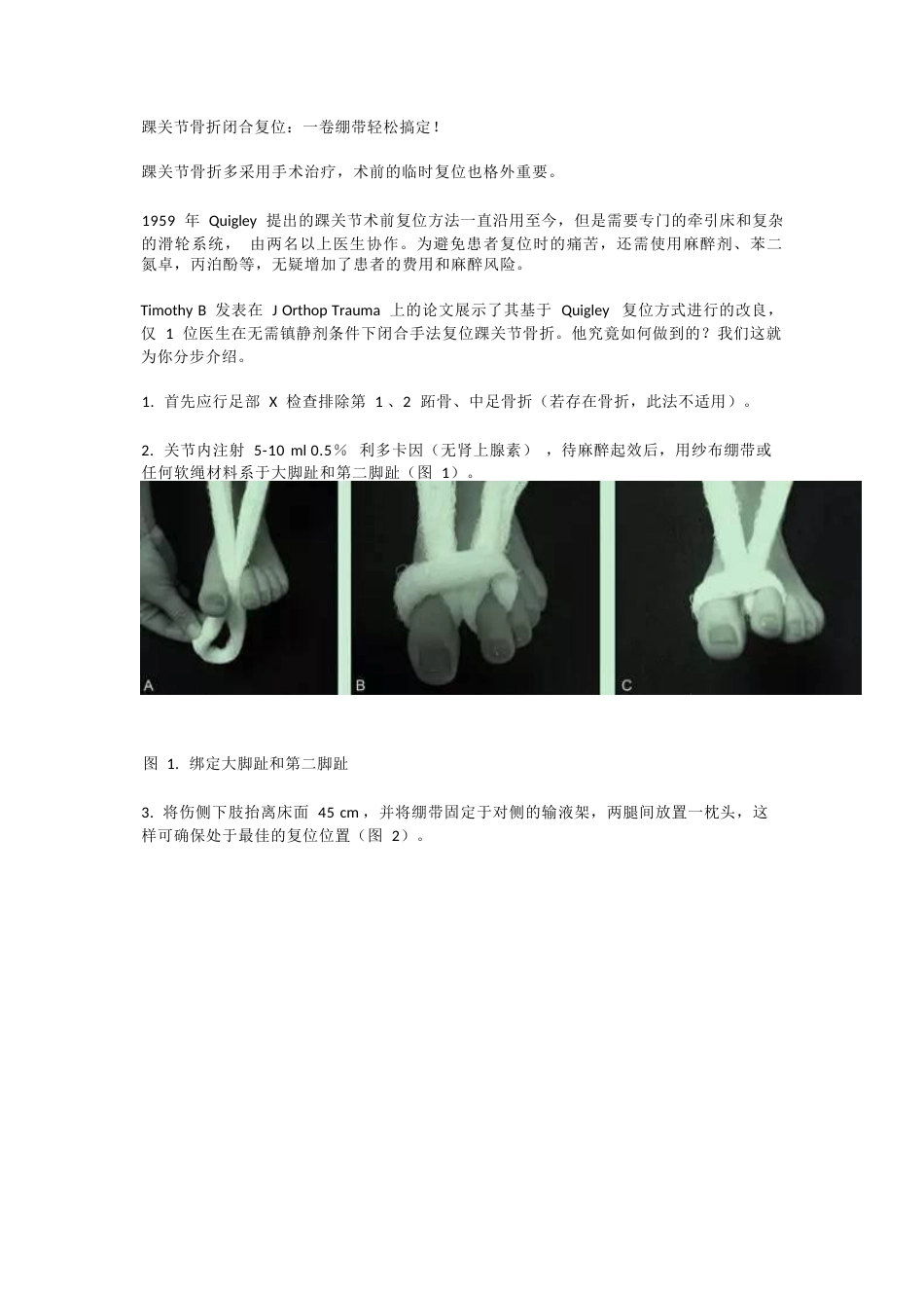 踝关节骨折闭合复位技巧_第1页
