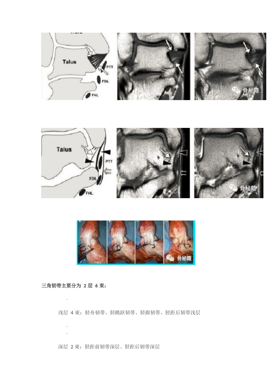 内踝三角韧带应力测试_第2页