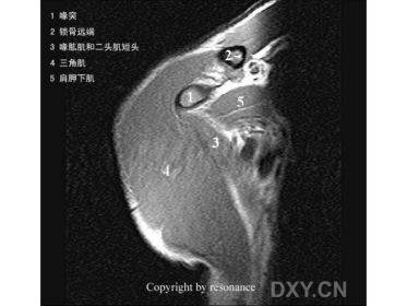 肩关节正常MRI解剖图谱