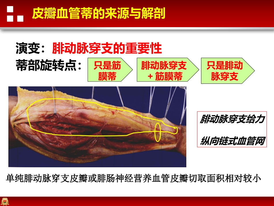 带蒂皮瓣转移修复足踝部创面_第13页