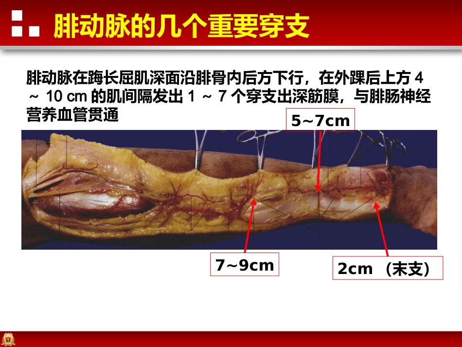 带蒂皮瓣转移修复足踝部创面_第14页