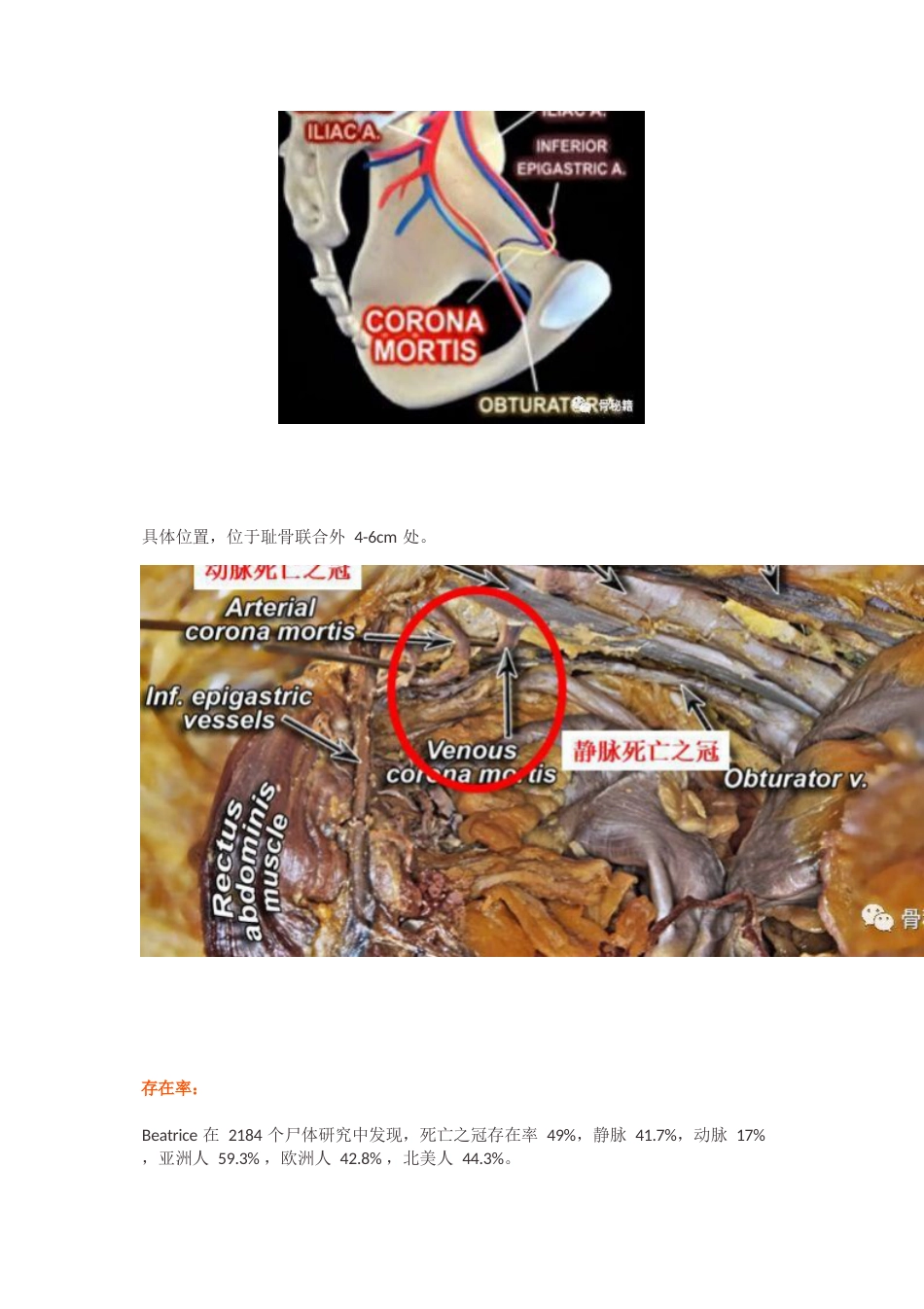 “死亡之冠”，应该如何处理？_第2页