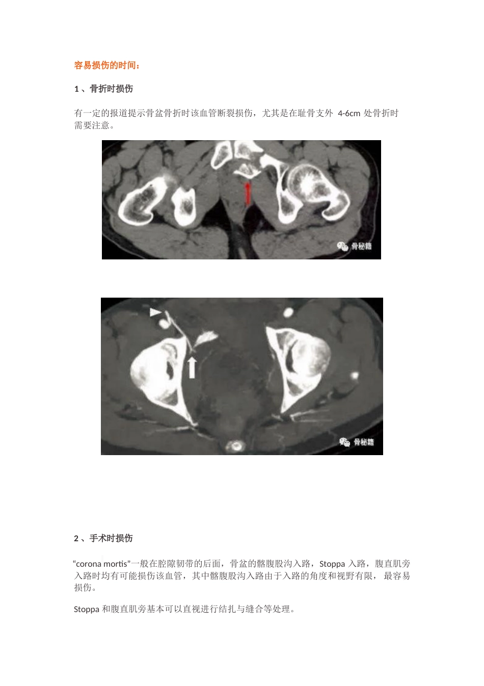 “死亡之冠”，应该如何处理？_第4页