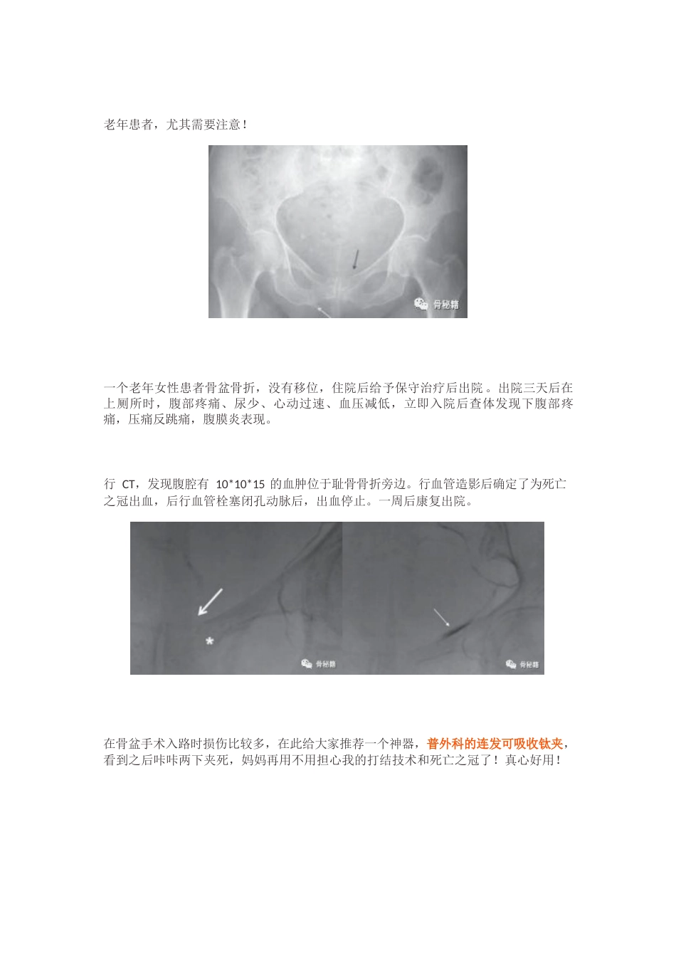 “死亡之冠”，应该如何处理？_第6页