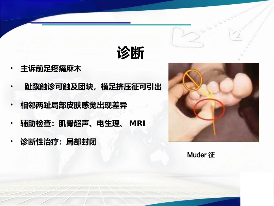 跖间神经瘤_第7页