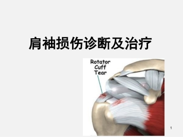 肩袖损伤诊断与治疗