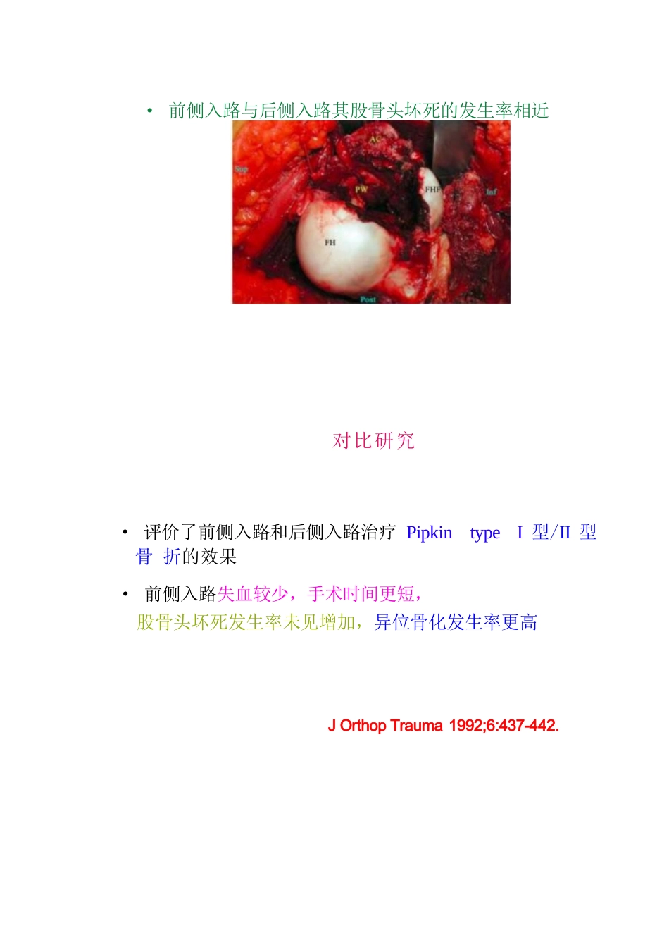 股骨头骨折的手术入路及方法_第15页