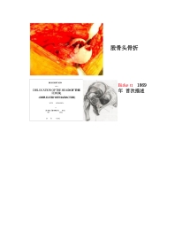 股骨头骨折的手术入路及方法