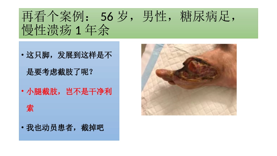 糖尿病足一定要截肢吗？_第15页