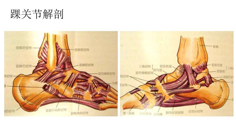 踝关节撞击综合征影像学表现_第7页