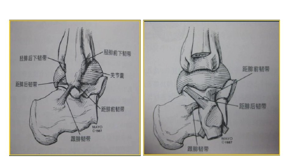 踝关节撞击综合征影像学表现_第8页