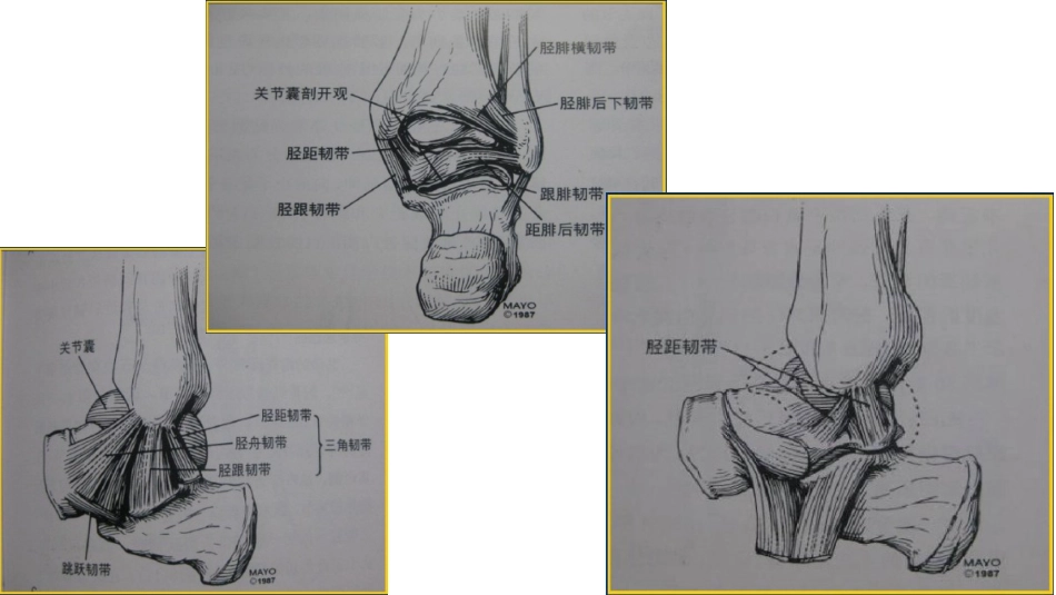 踝关节撞击综合征影像学表现_第9页
