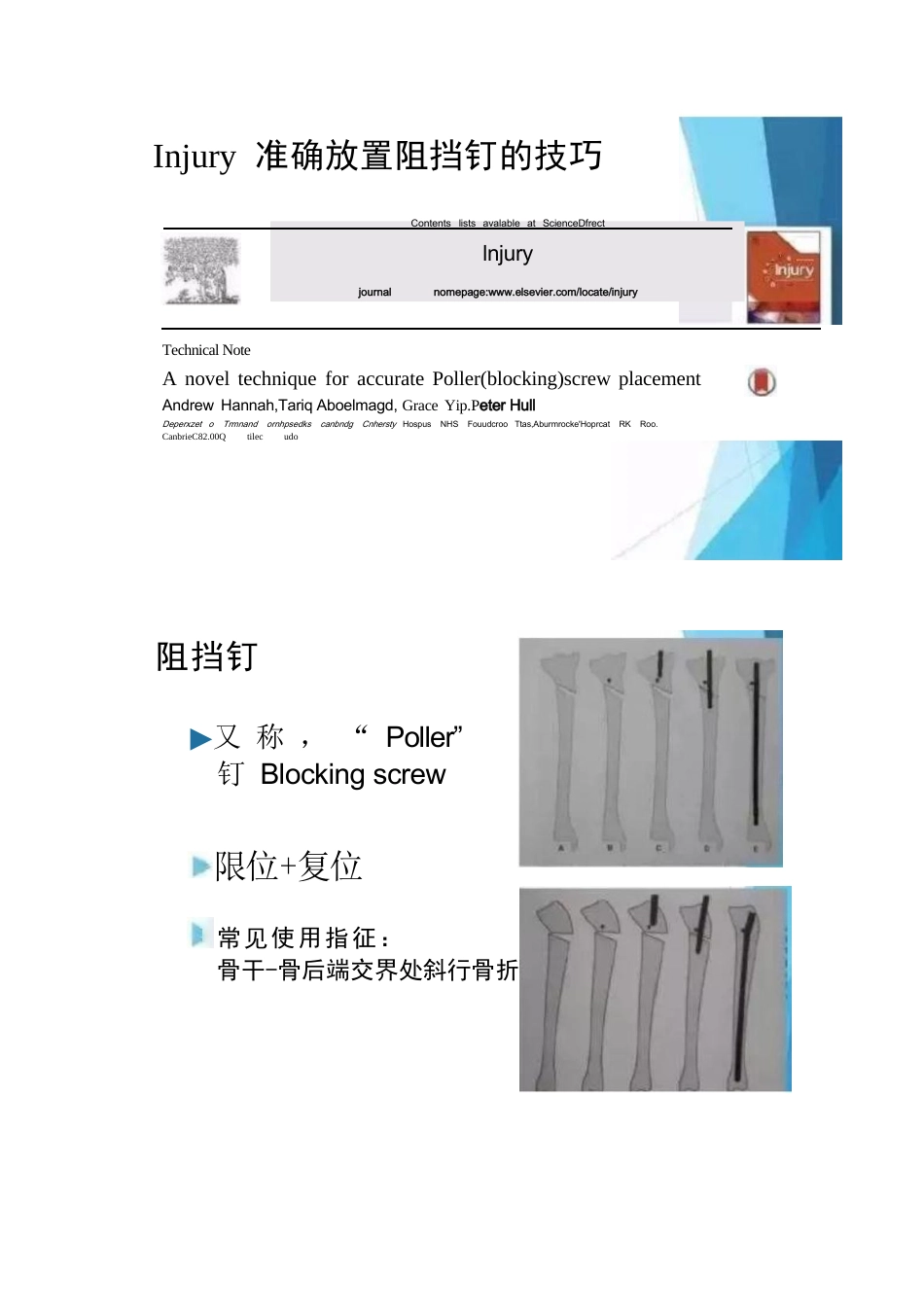 放置阻挡钉技巧_第1页
