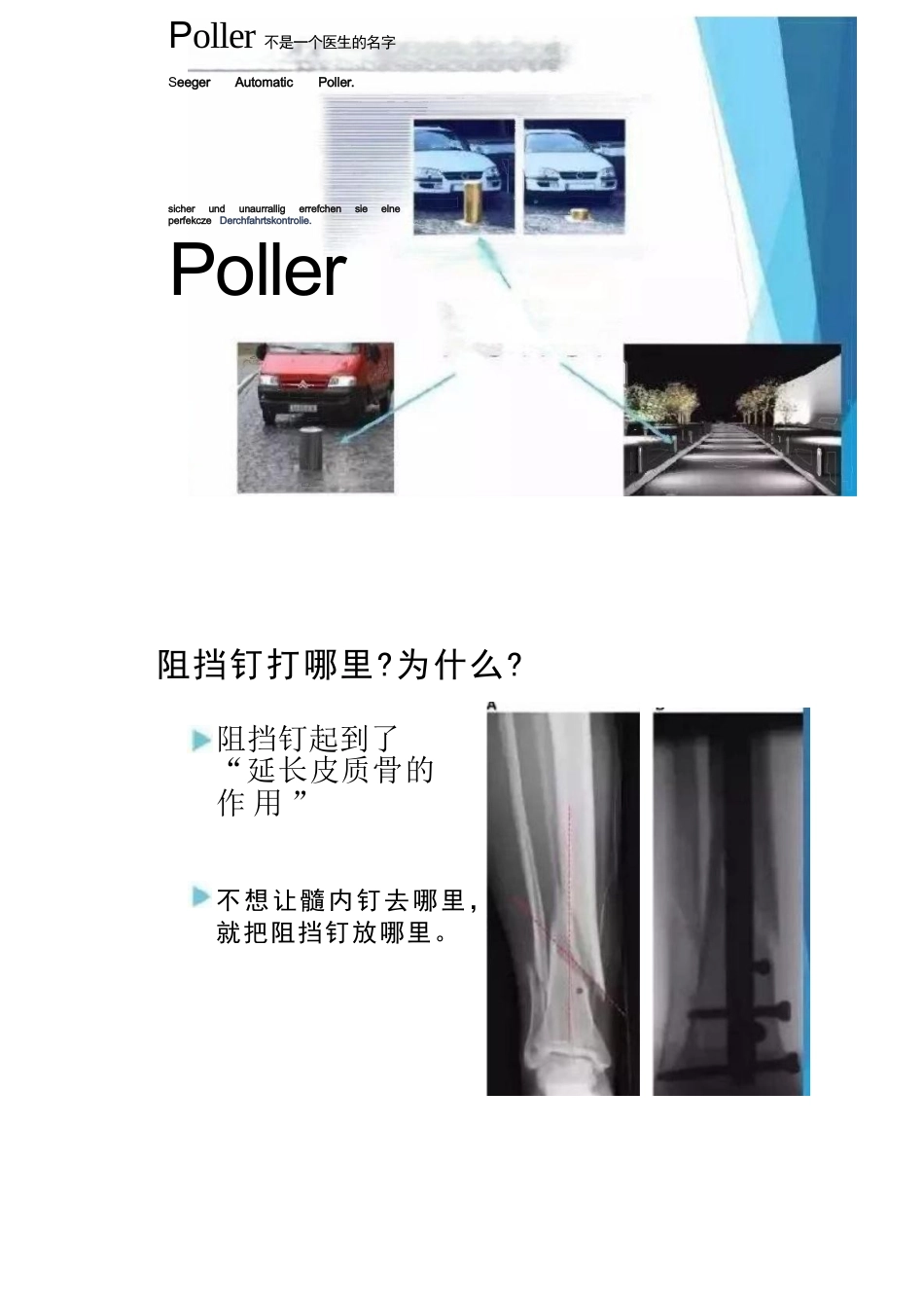 放置阻挡钉技巧_第2页