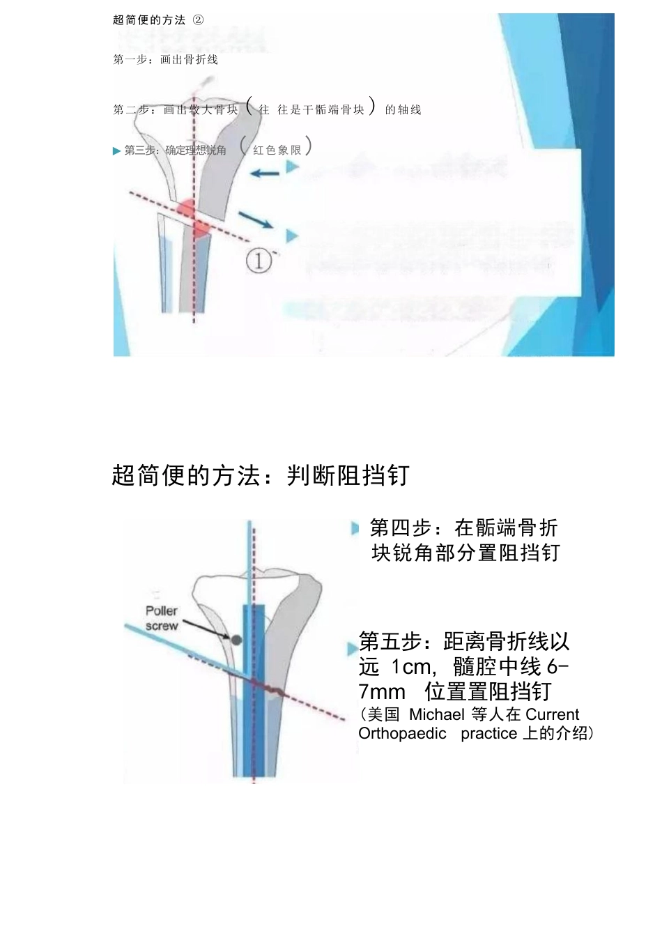 放置阻挡钉技巧_第3页