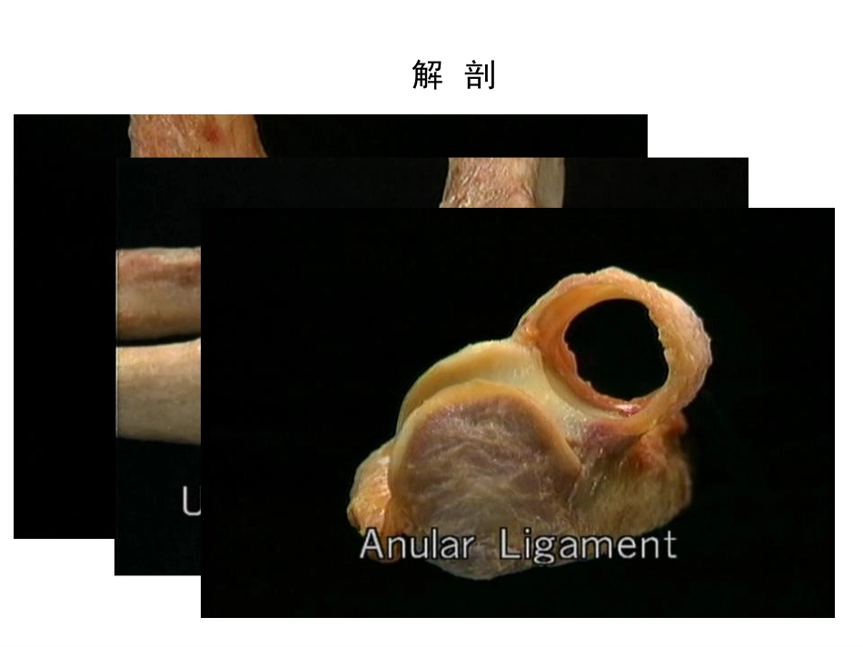 肘关节手术入路_第8页