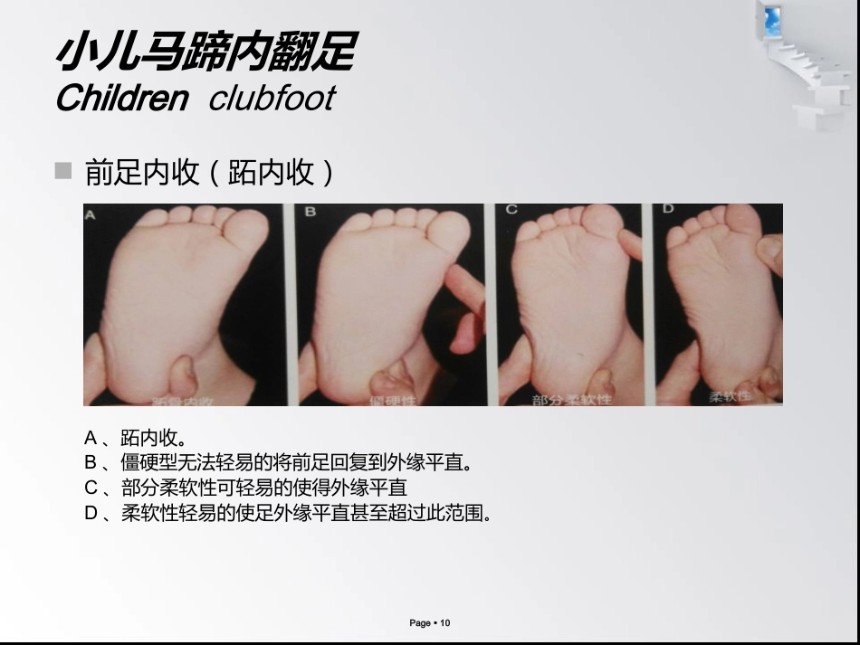 小儿马蹄内翻足_第10页