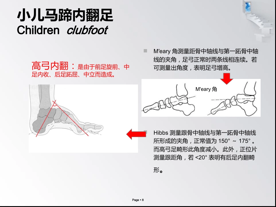 小儿马蹄内翻足_第8页