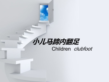 小儿马蹄内翻足