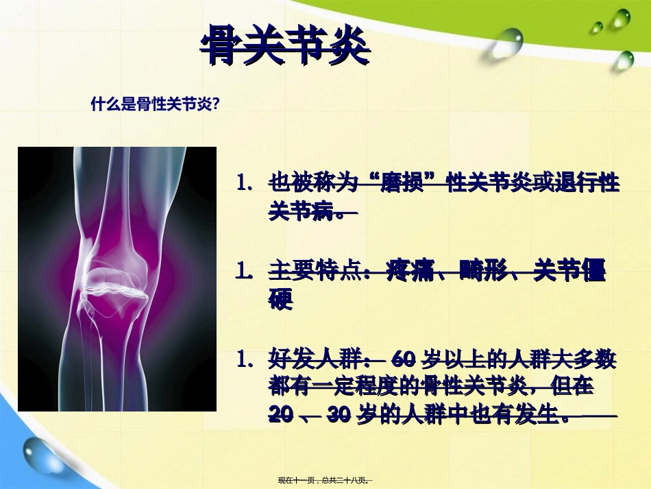 老人骨性关节炎诊疗患教讲课文档_第11页